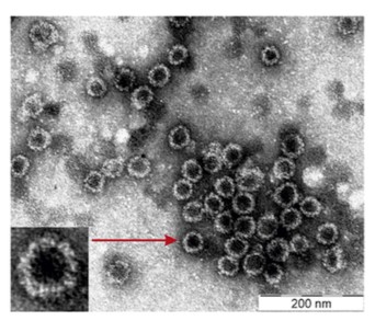 Mempro™ Virus-like Particles (VLPs) Production in Bacterial Cells System