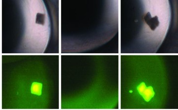 Visualization of  crystals using TFL  method.