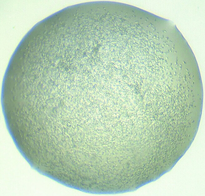 Protein crystallization and optimization