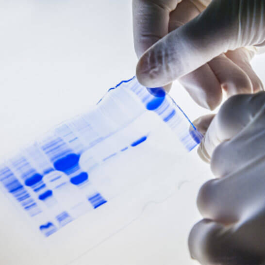 Cryo-Electron Microscopy (Cryo-EM) Services