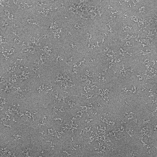 Negative staining TEM