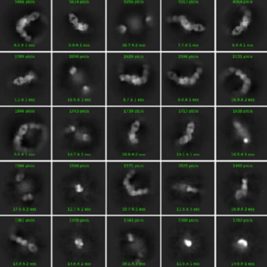 Cryo-EM data collection and condition optimization