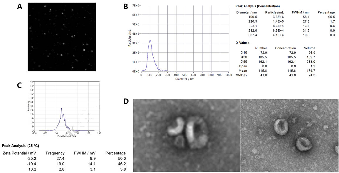 Exosomes analyzed by NTA, zeta potential, and TEM showing size, charge, and morphology.