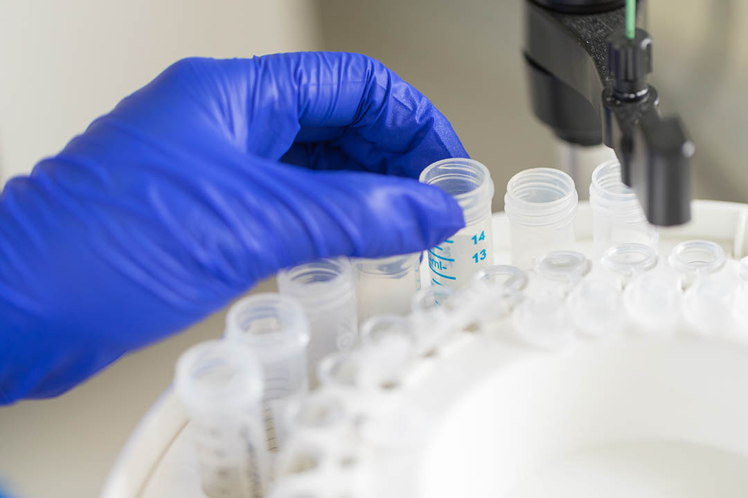 Protein Purification