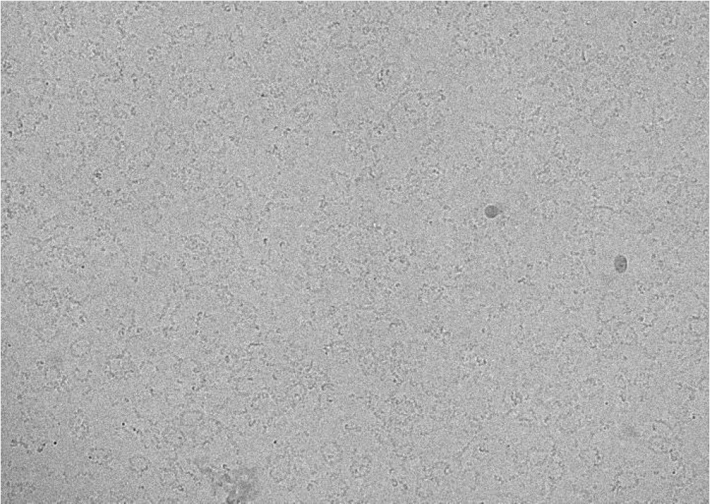 Cryo-TEM image of CDXX-antibody complex.