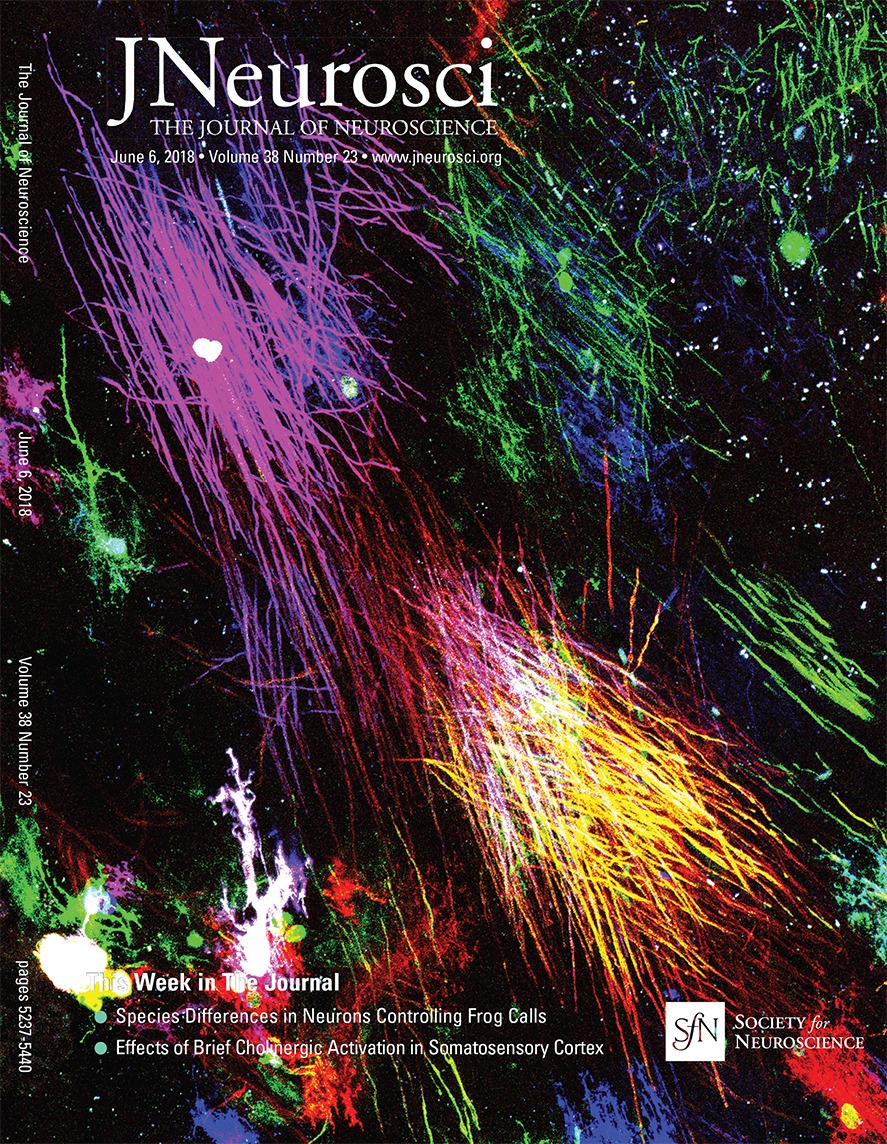 JNeurosci: New Method for the Development of Personalized Brain Stimulation Therapies Found