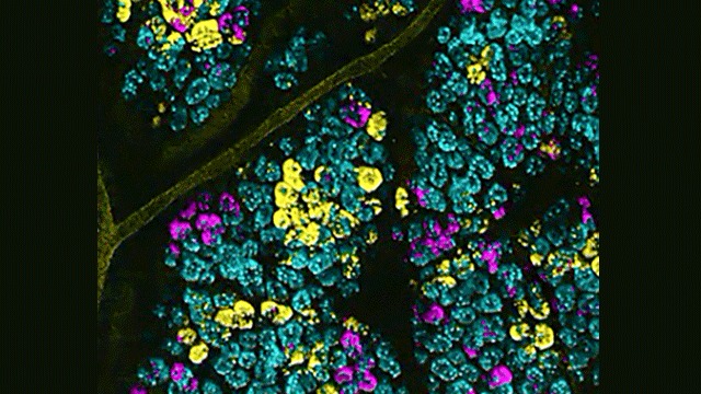 Using New Imaging Technology to Reveal the Mechanism of Cancer Cell Growth and Spread in Colon