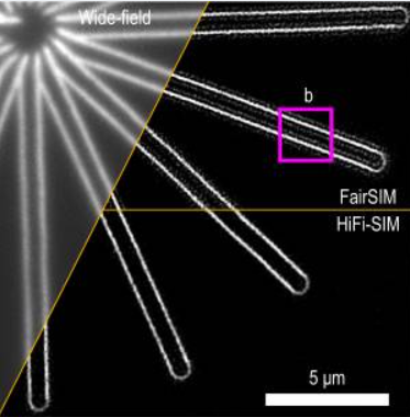 Progress in Research and Instrument Development of Structured Light Illumination Super Resolution Microscopy