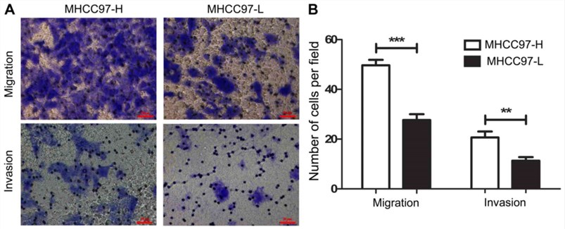 In vitro migration and invasion assays.