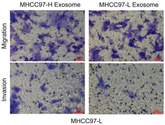 In vitro migration and invasion assays incubation with exosomes. 