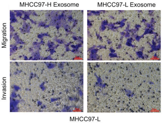 In vitro migration and invasion assays incubation with exosomes. 