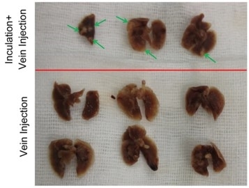 Primary tumor-derived exosomes were intravenously injected into mice. 