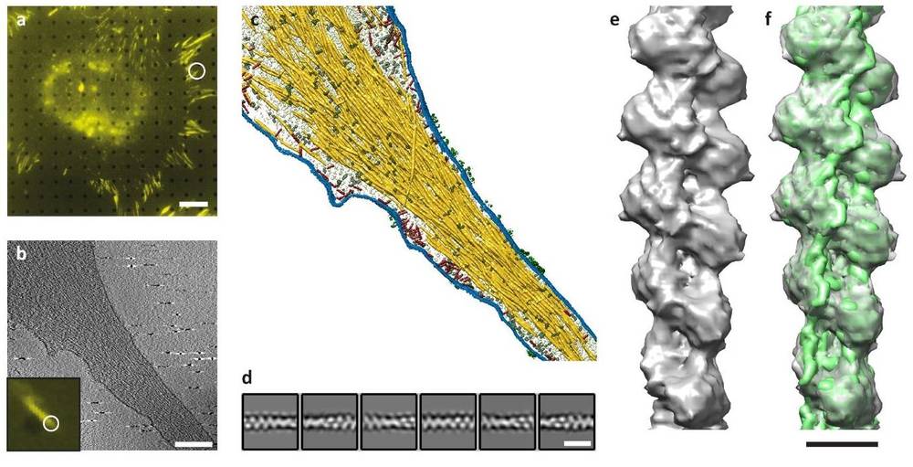 Cryo-ET and fluorescence microscopy reveal actin filament structures at focal adhesions in cells.