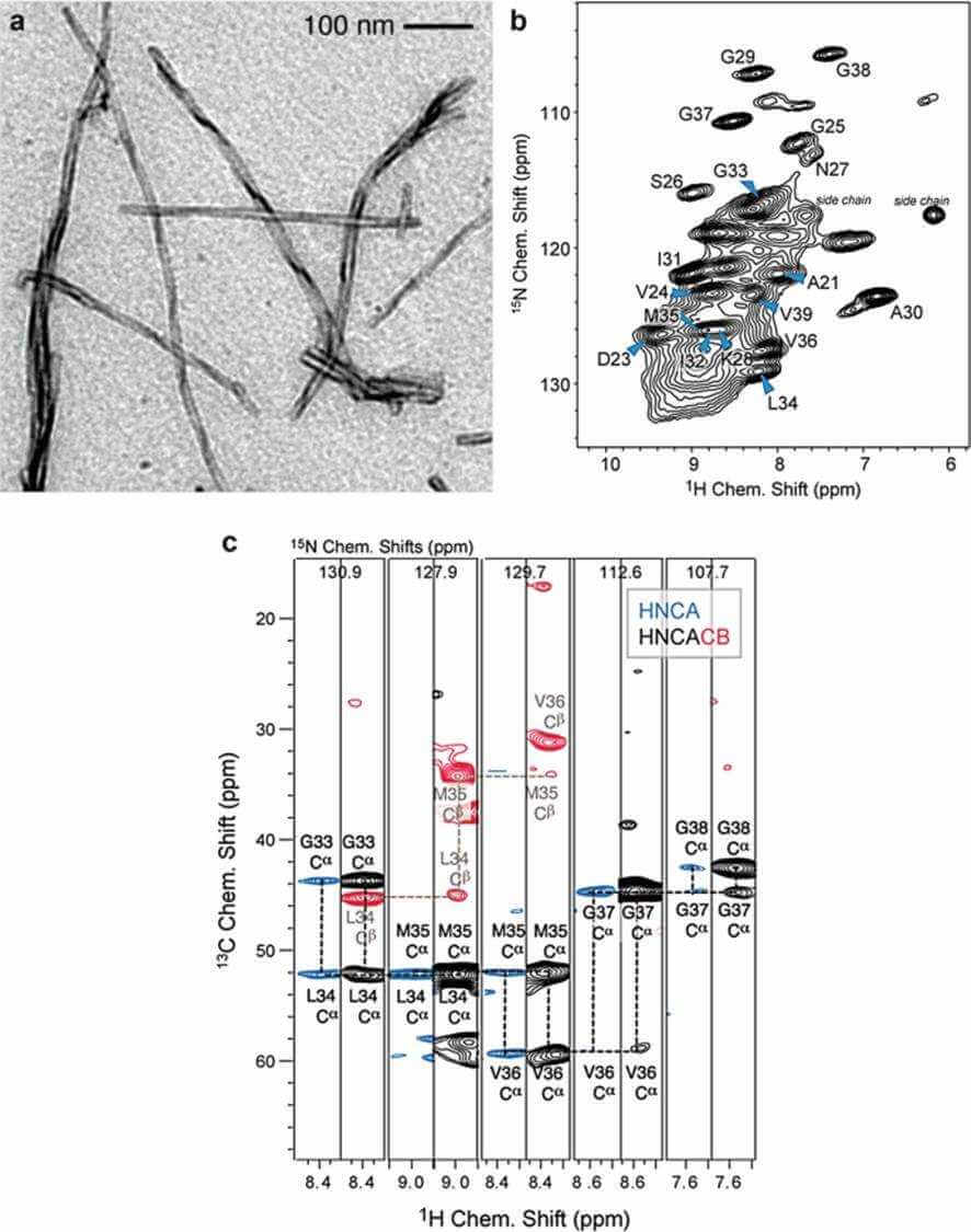 MAS solid-state NMR experiments recorded for a perdeuterated Alzheimer's disease peptide Aβ fibrils