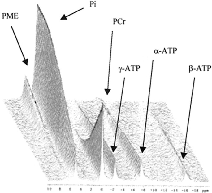 Stacked plot of 31P NMR spectra acquired continuously from 20 min postmortem until 12 h postmortem on a porcine muscle sample