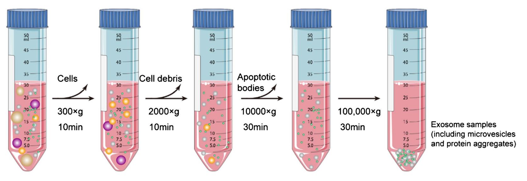 Figure 1. Flow chart for isolation of exosomes by differential ultracentrifugation.