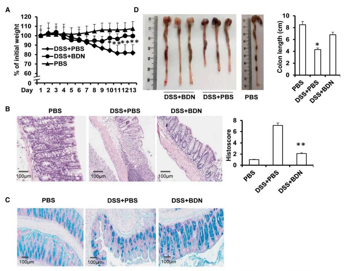 Figure 3. Broccoli-derived exosomes for the therapy of colitis.