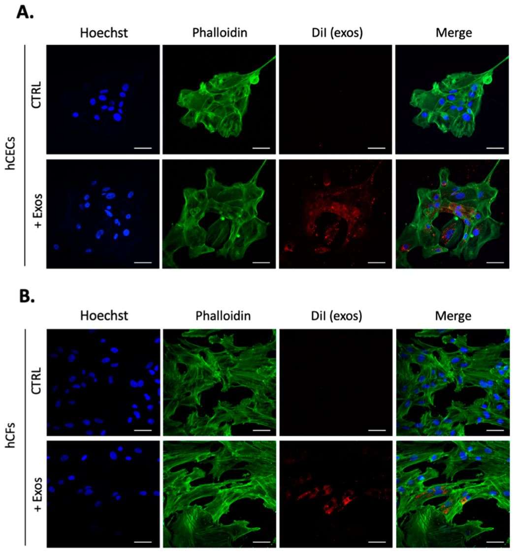 Figure 2. Schematics of exosome labeling with lipophilic dye DiI.