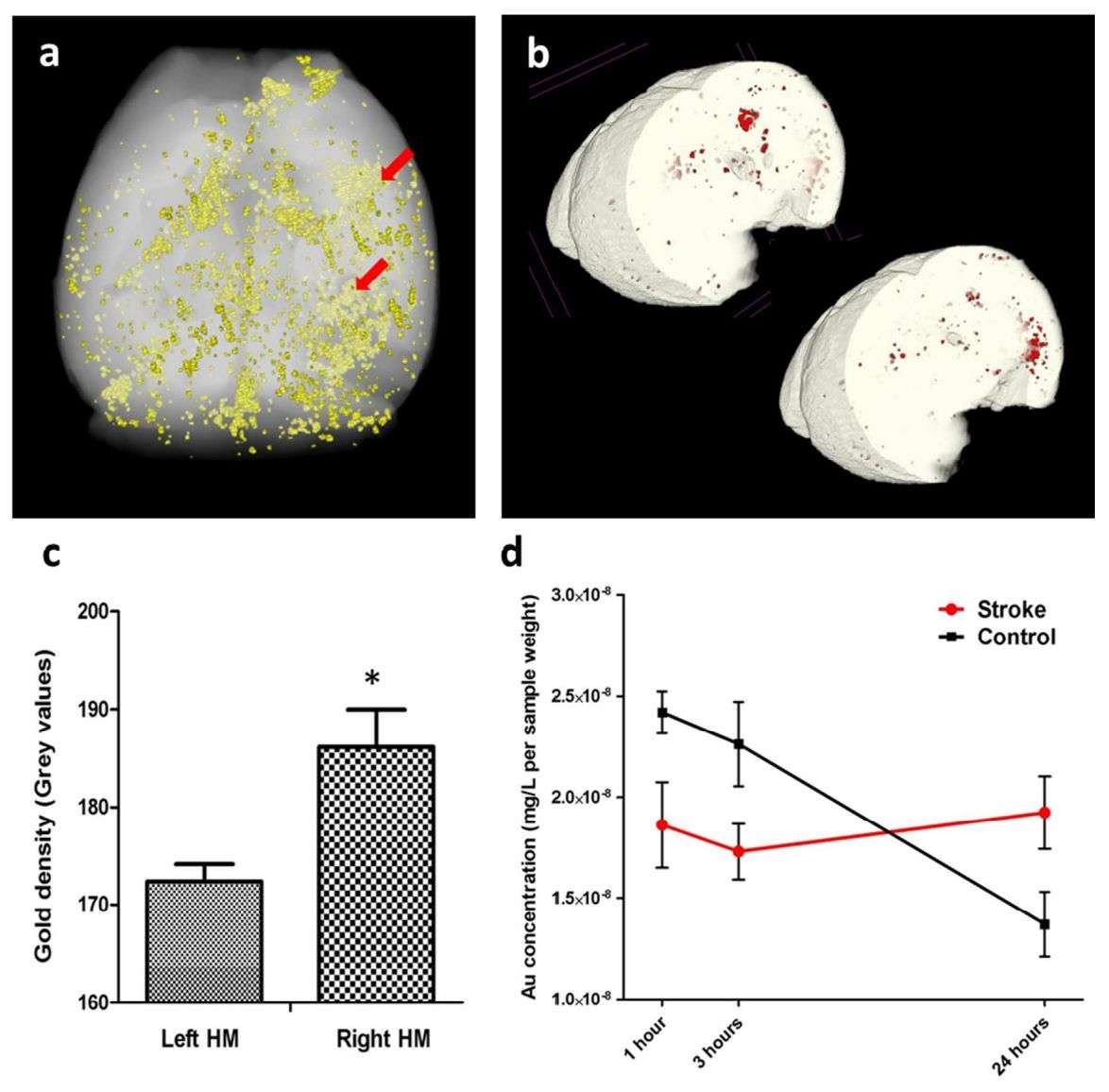 Figure 4. Brain injection of GNPs-labeled exosomes.