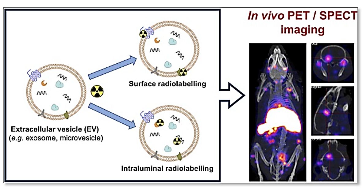 Figure 1. Strategies for labeling exosomes by radioisotopes.