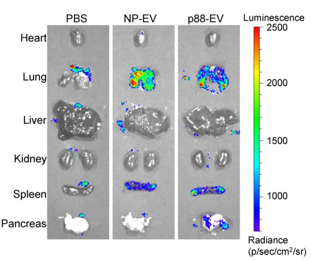 Figure 3. Schematic imaging of organs in mice injected intravenously with luciferase.