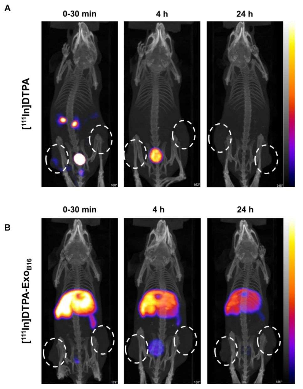 Figure 4. SPECT/CT image of membrane-labeled exosomes in melanoma-bearing mice.