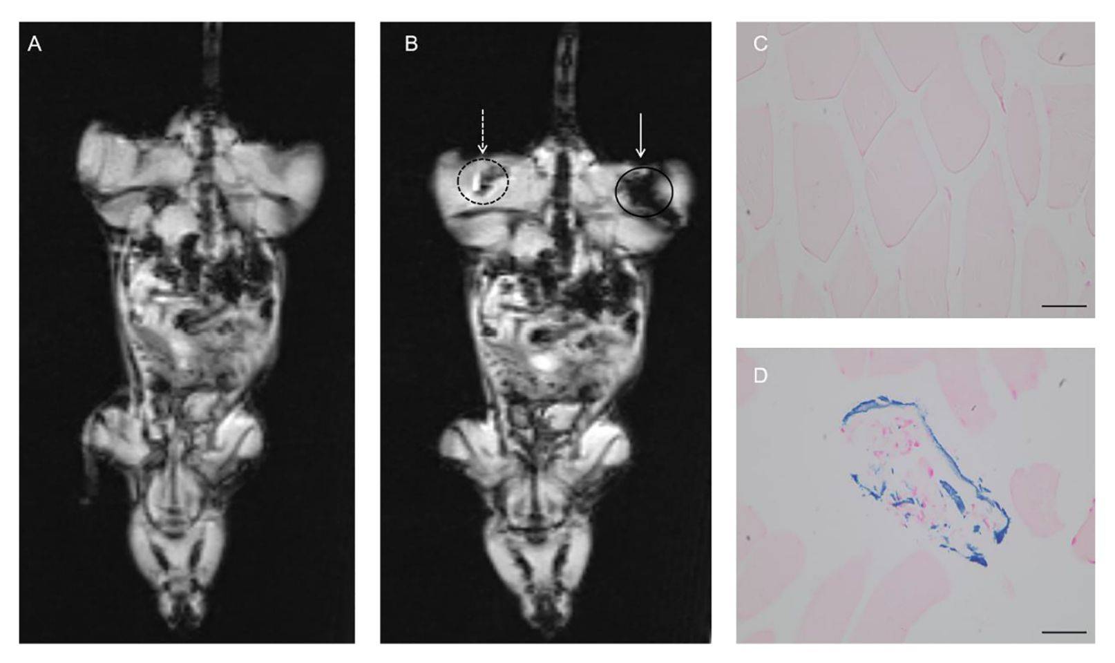 Figure 4. MRI visualization of MSC/FTH1 exosomes.