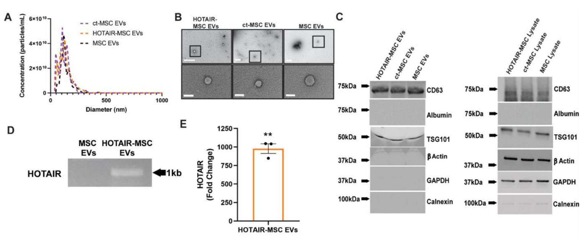 Figure 4. Exosomes loaded with HOTAIR by transfection.