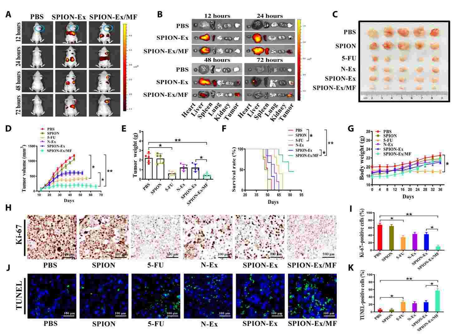 Figure 3. Tumor targeting ability of SPION-Ex.