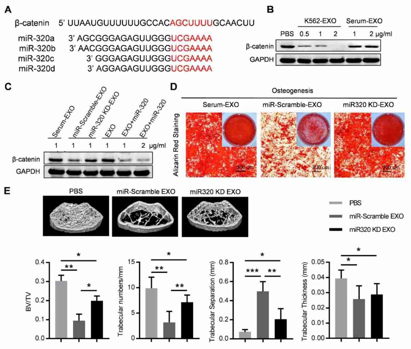 Figure 1. Exosome miR-320 promotes CML development.