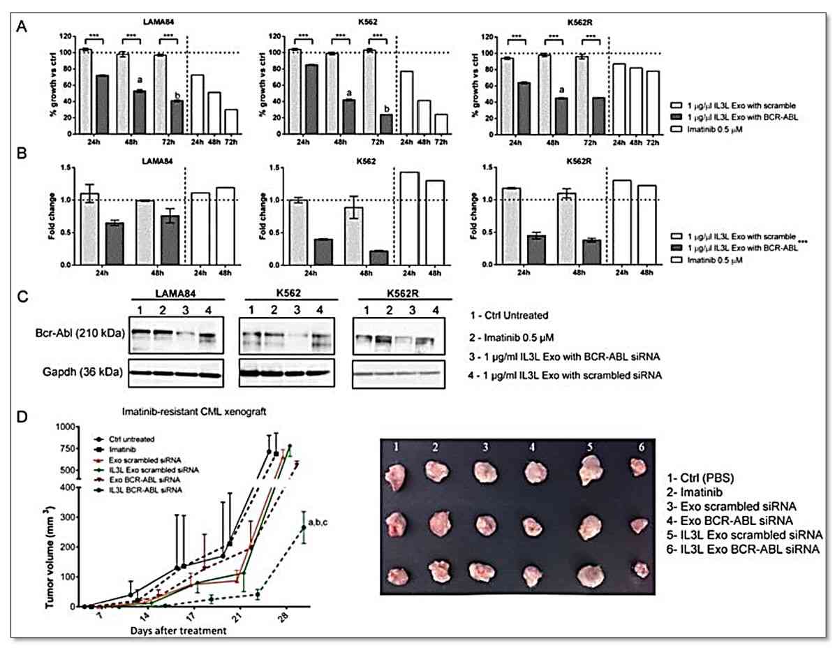 Figure 2. Therapeutic efficacy of siRNA-loaded targeted exosomes for CML.