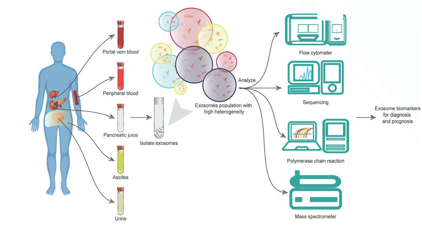 Figure 2. Exosomes as biomarkers of pancreatic cancer.