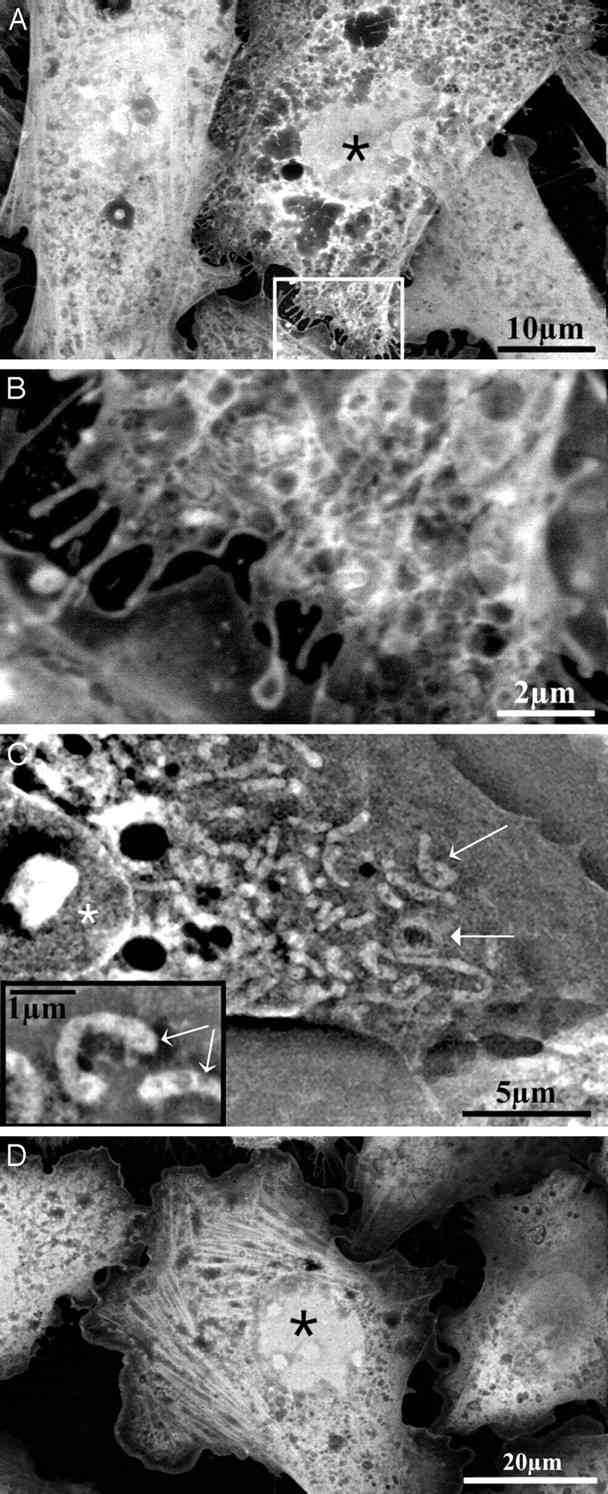An example of studying cellular structure with SEM.