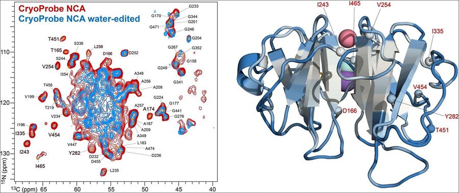 Solid-state NMR MAS CryoProbe enables structural studies of human blood protein vitronectin bound to hydroxyapatite.