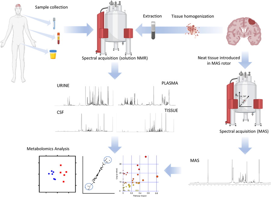 HRMAS NMR metabolomics analysis of brain tumor tissue samples.