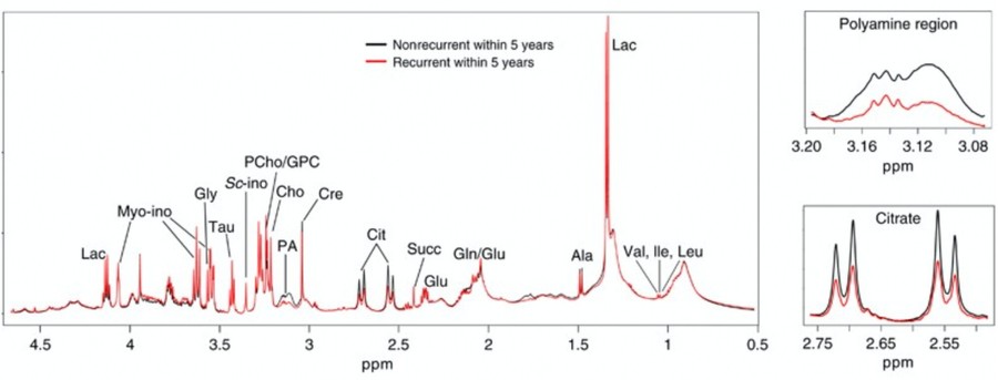 HRMAS NMR metabolomic profiling of prostate cancer tissues.