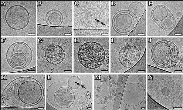 Cryo-EM images of extracellular vesicles (EVs) isolated from pooled CSF of Parkinson's disease patients