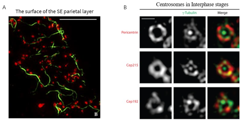 3D-SIM  image of subcellular structure