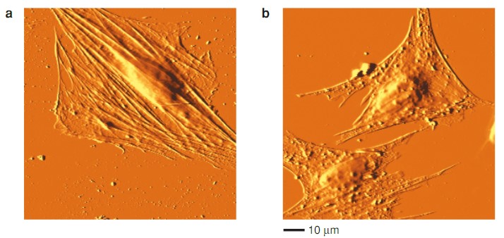 Examples of results of scanning cells with an AFM in contact mode in liquid.