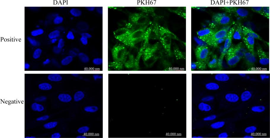 Figure 1. Uptake of PKH67 labeled exosomes by granulosa cells after co-incubation in vitro.