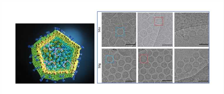 Cryo-TEM micrographs of the phytosterol LNPs