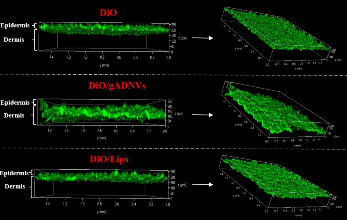 DiO/gADNVs penetrate deep into dermis, while free DiO and liposomes remain in epidermis, showing potential for transdermal drug delivery.