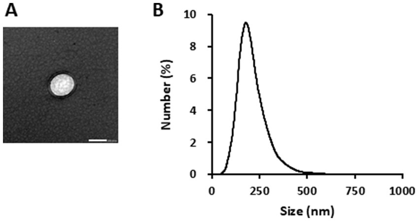 TEM and size analysis of kale-derived exosome-like nanovesicles show round morphology and uniform nanoparticle distribution around 212 nm.