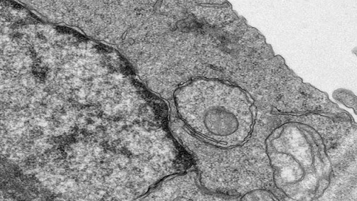 Transmission Electron Microscopy (TEM) Products